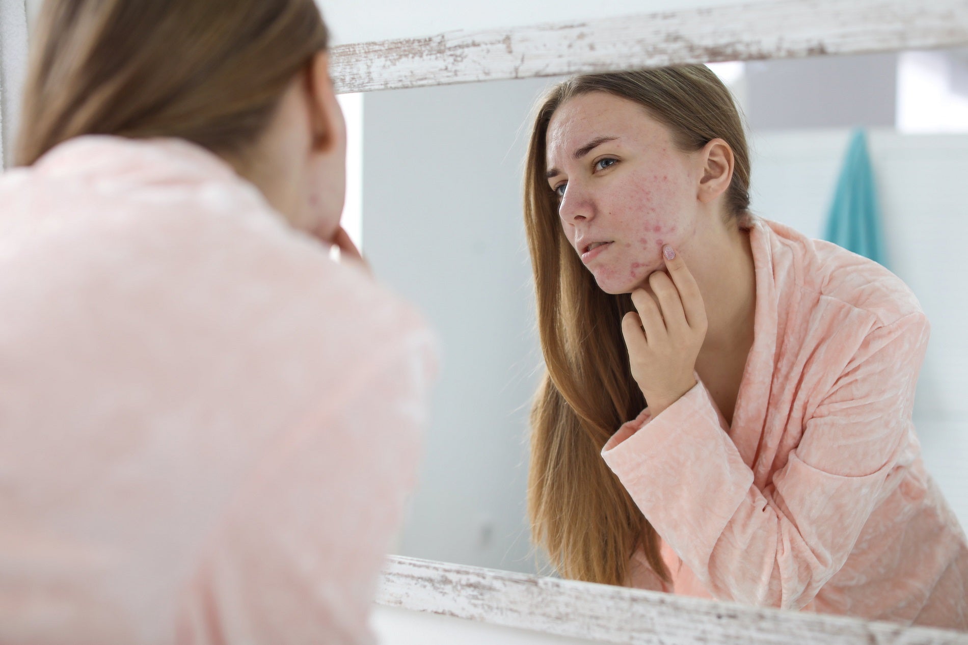 Infrared sauna for acne